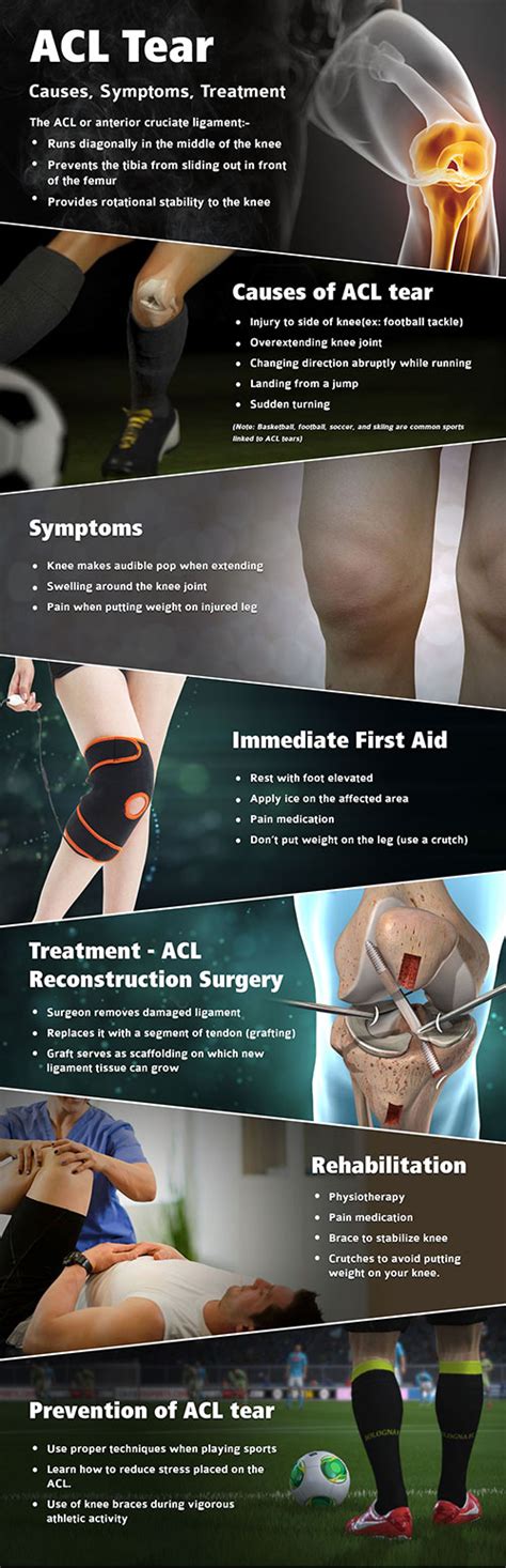 Anterior Cruciate Ligament Acl Tear Acl Reconstruction