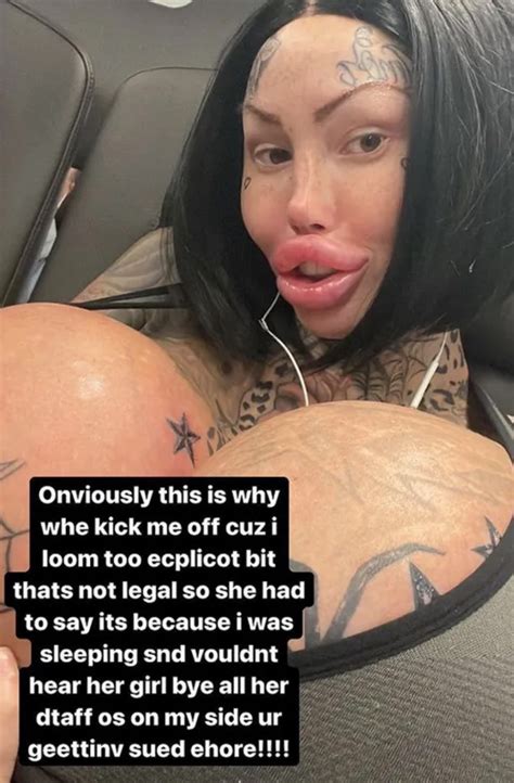 Surgery Addict Instagram Model Slammed Over Her Claim She Was Kicked
