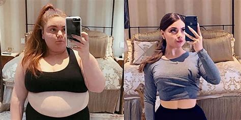 5 Inspiring Weight Loss Success Stories With Gastric Sleeve Surgery