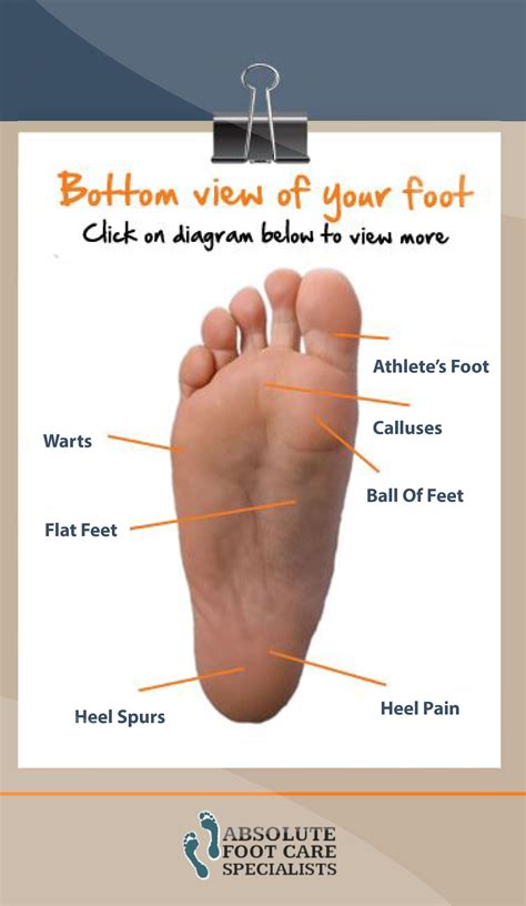 Foot Pain Diagram