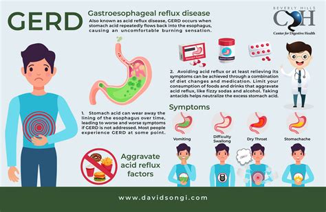 Gerd Symptoms And Causes Gastroenterologist Los Angeles