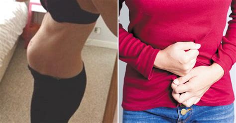 Year Old Woman Whose Stomach Was Bloated For Months Discovered What