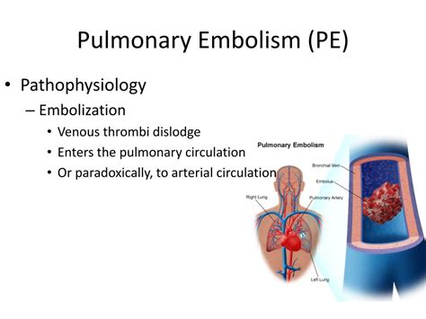Deep Vein Thrombosis And Pulmonary Embolism Symptoms And More