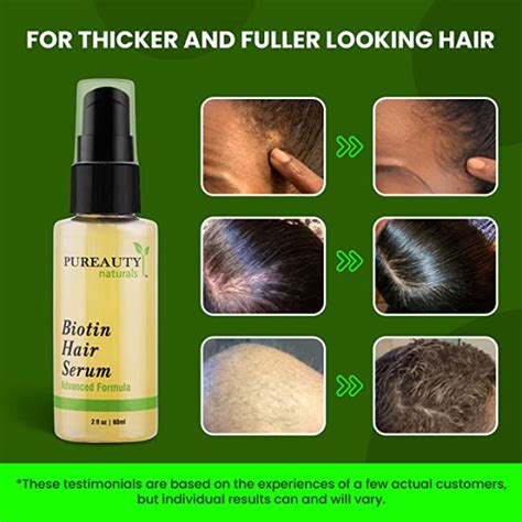Buy Pureauty Naturals Biotin Hair Growth Serum 60 Ml Online At Best