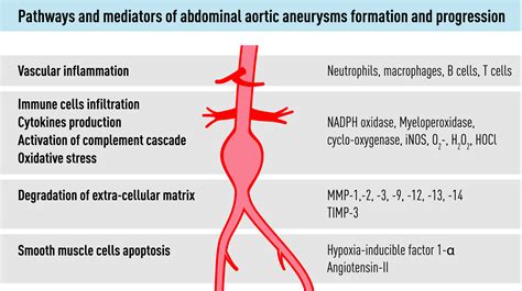 Abdominal Aortic Aneurysms Pathophysiology And Clinical Issues My XXX Hot Girl