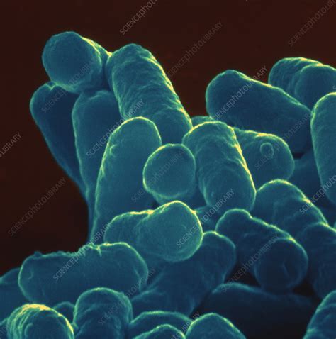 Coloured Sem Of Escherichia Coli Bacteria Stock Image B2300141