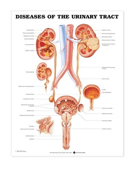 2000 Diseases Of The Urinary Tract Anatomical Chart Pdf By Anato