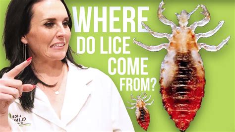 What Causes Head Lice How To Prevent Lice Youtube