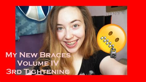 Home › about braces › recently get your braces tightened? BRACES 4 | 3rd Tightening - YouTube