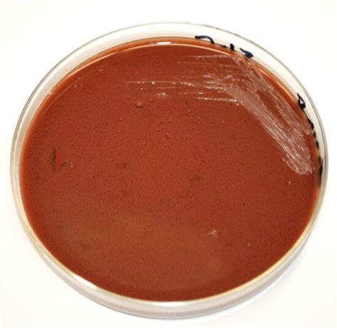 Imagen Gratis Brucella Abortus Bacterias Crecido Chocolate Agar