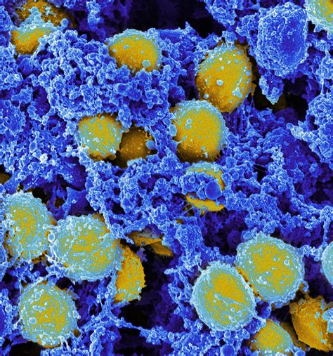 Staphylococcus Aureus Bacteria Sem Photograph By Science Source