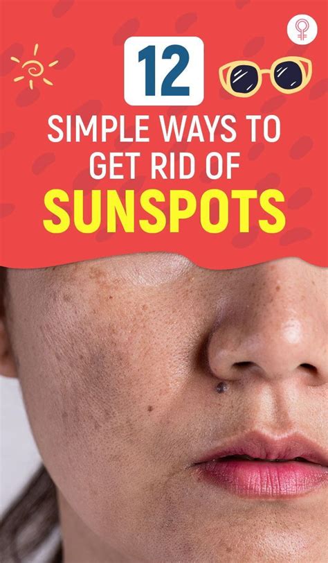 12 Simple Ways To Get Rid Of Sunspots Home Remedies Are By Far The