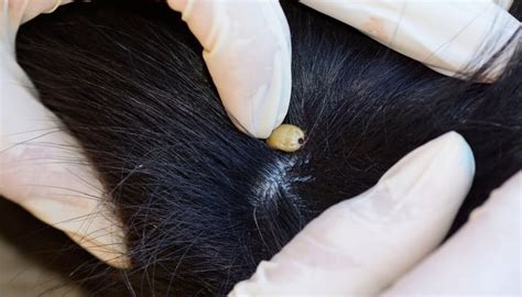 How To Remove A Tick From A Dog Our Step By Step Guide Top Dog Tips