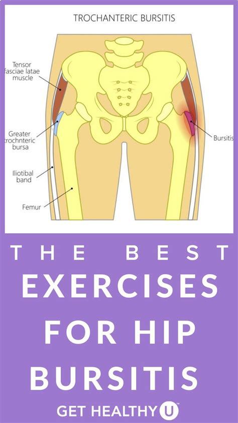 The Best Exercises For Hip Bursitis An Immersive Guide By Get Healthy U Chris Freytag