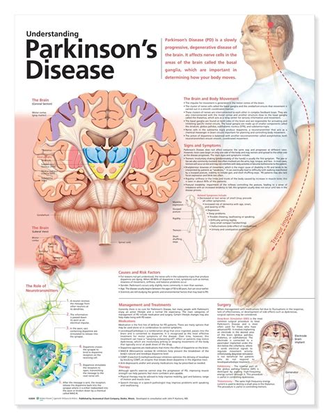 Understanding Parkinsons Disease Poster Parkinsons Anatomical Chart