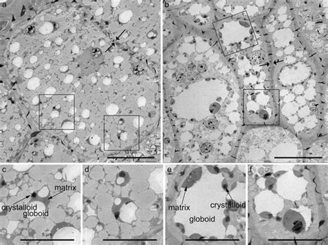 Transmission Electron Microscopy Tem Showing The Aleurone Cell