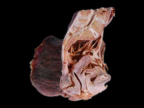Detailed and high textured 4k normal,disp,diffuse. Median saggital section of female pelvis plastinated ...