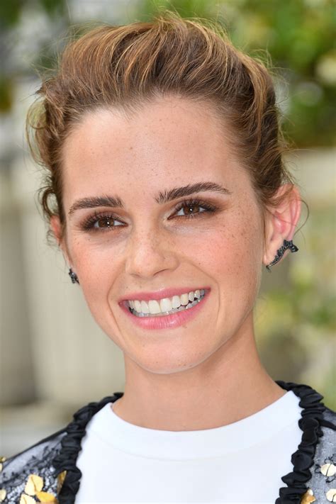 Emma Watson Before And After Beautyeditor