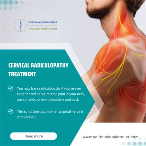 Cervical Radiculopathy A Systematic Review On Treatment By Spinal Hot