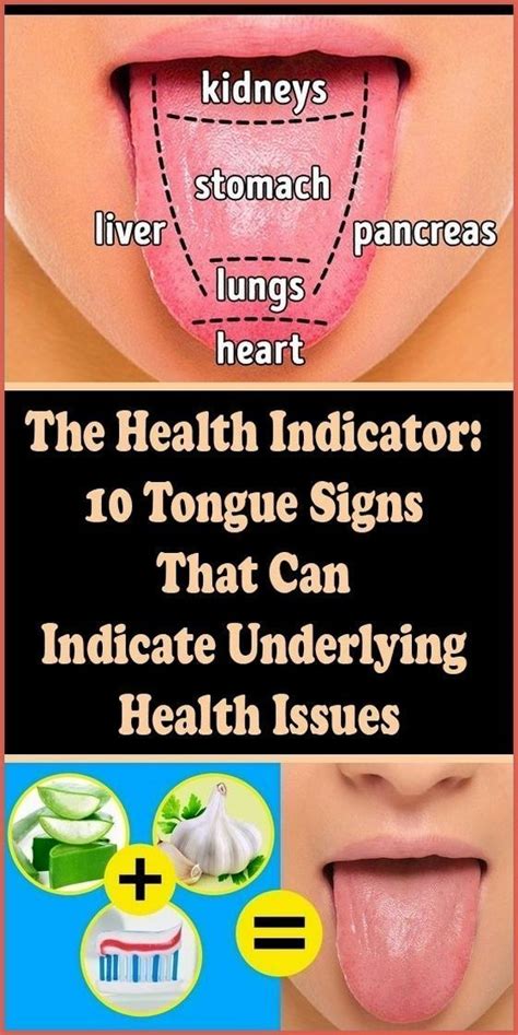 The Health Indicator 10 Tongue Signs That Can Indicate Underlying