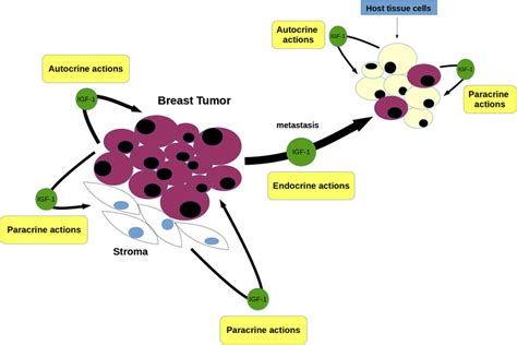 The Role Of The Insulin Like Growth Factor 1 System In Breast Cancer