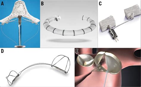 A Double Shot At The Mitral Valve Combined Transcatheter Mitral Valve