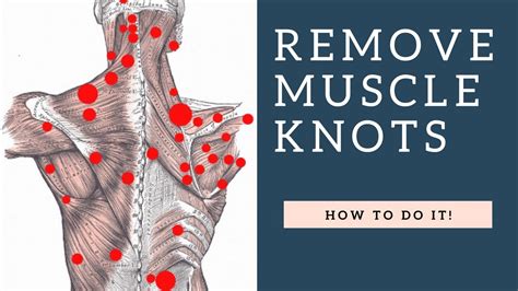 Best Way To Fix Shoulder Knots Myofascial Trigger Points In Your