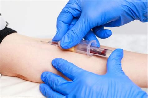 Blutentnahme Behandlung Wirkung Risiken Gesundpedia De