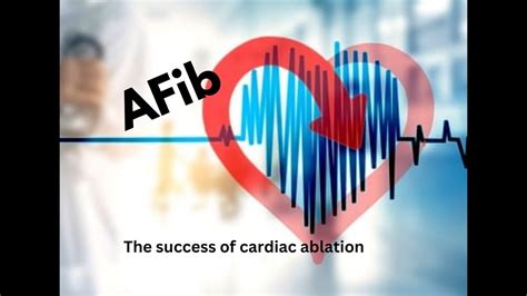 Afib And The Success Of The Cardiac Ablation Procedure Youtube