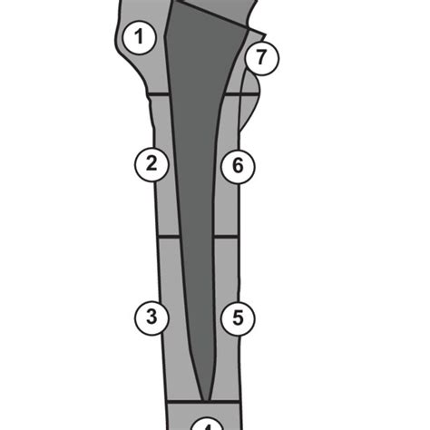 The Seven Gruen Zones A Model For The Evaluation Of Hip Periprosthetic