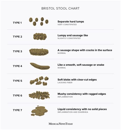 Ultimate Constipation Guide Wise And Wonder — Wise And Wonder