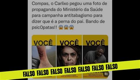 É falso que foto da perna de Bolsonaro erisipela seja de campanha