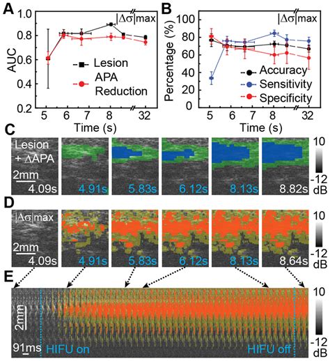 Spatiotemporal Correlation Of Apa With Parametric Ultrasound