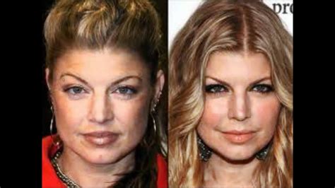 See Before And After Photos Of Celebrities Who Underwent Plastic