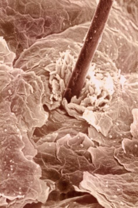 Surface Of Human Skin With A Hair Follicle And Squamous Epithelium