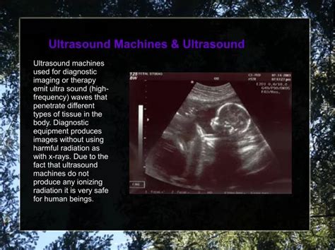 Ppt What Is Ultrasound Powerpoint Presentation Free Download Id