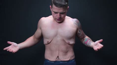 Maybe you would like to learn more about one of these? Obese to Beast: Guy Bravely Strips Down to Show What ...