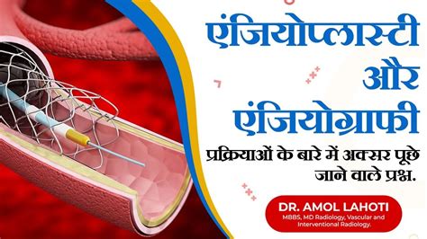 Top Faqs About Angiography And Angioplasty Procedures By Dr Amol