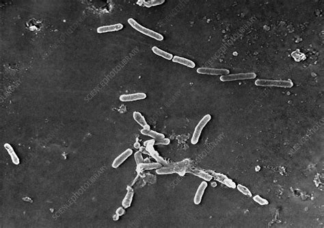 Pseudomonas Aeruginosa Bacteria Sem Stock Image C0448695