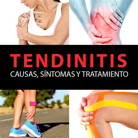 Tendinitis Causas Síntomas Y Tratamiento La Guía De Las Vitaminas