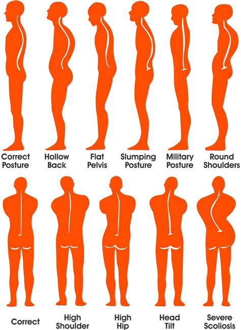 Posture Correction And Ergonomics Bodyworks Chiropractic