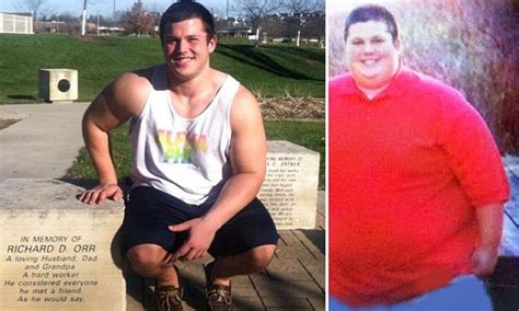 Obese Teen Who Ate To Cope With Fathers Death Sheds 300lbs Daily