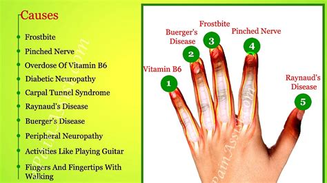 Numb Index Finger Left Hand Index Choices