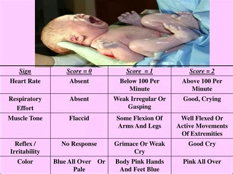Ppt Modified Glascow Coma Scale For Infants And Children Powerpoint Images