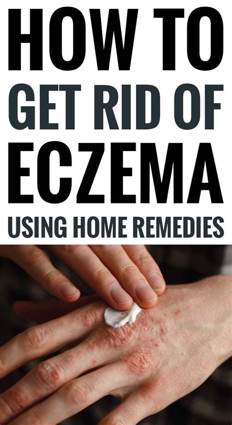 Eczema Is That Condition Wherever Skin Patches Become