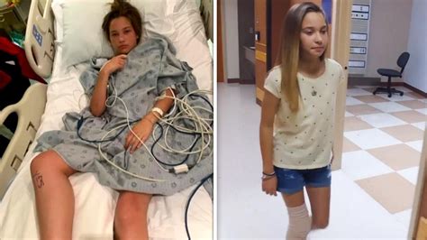 12 Year Old Walks After Overcoming Flesh Eating Bacteria Youtube