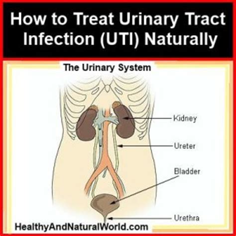How To Treat Urinary Tract Infection UTI Naturally