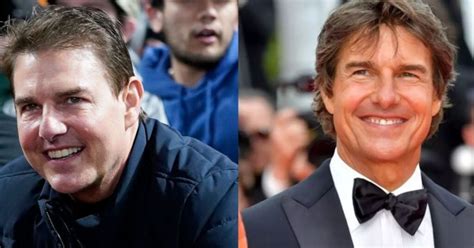 Did Tom Cruise Get Plastic Surgery