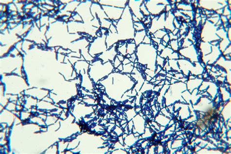Bacillus Cereus Gram Stain