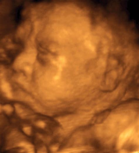 31 Weeks And 5 Days Pregnant Baby Fetal Progress Ultrasound